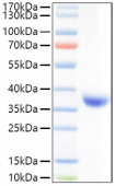 Recombinant SARS-COV-2 Spike RBD(Lambda/C.37)  Protein (RP01477)