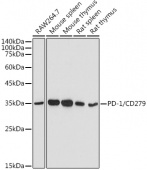 [KO Validated] PD-1/CD279 Rabbit pAb (A5584)
