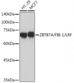 ZBTB7A/FBI-1/LRF Rabbit mAb (A19785)