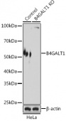 [KO Validated] B4GALT1 Rabbit pAb (A8546)