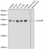 [KO Validated] CACYBP Rabbit pAb (A8757)