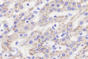 Anti - E Cadherin Rabbit Western Blot Immunohistochemistry immunofluorescence polyclonal antibody