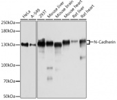 [KO Validated] N-Cadherin Rabbit pAb (A21308)