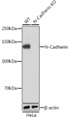 [KO Validated] N-Cadherin Rabbit mAb (A19083)