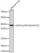 ADH1A/ADH1B/ADH1C Rabbit pAb (A18581)