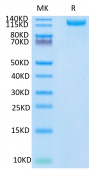 Recombinant SARS-COV-2 Spike S1(N501Y) Protein (RP02324)