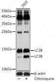 [KO Validated] LC3B Rabbit pAb (A11280)