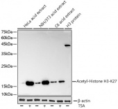 Acetyl-Histone H3-K27 Rabbit mAb (A2771)