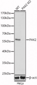 [KO Validated] PAK2 Rabbit pAb (A21522)