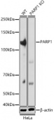 [KO Validated] PARP1 Rabbit pAb (A21365)