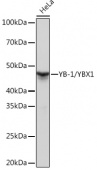 YB-1/YBX1 Rabbit mAb (A3534)
