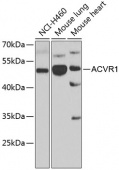 ACVR1 Rabbit pAb (A7542)