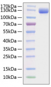Recombinant Mouse VCAM-1/CD106 Protein (RP01227)