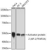 Activator protein 2 (AP-2/TFAP2A) Rabbit mAb (A2294)