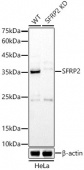 [KD Validated] SFRP2 Rabbit pAb (A22017)