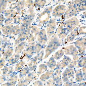 Anti -ACSS2 Rabbit pAb