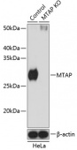 [KO Validated] MTAP Rabbit pAb (A19981)