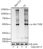 Phospho-Akt-T308 Rabbit mAb (AP1259)