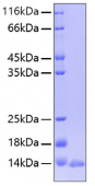 Active Recombinant Human Leptin/LEP Protein (RP00028)