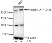 Phospho-ATR-S428 Rabbit mAb (AP1358)