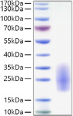 Active Recombinant Human IL-3 Protein (RP01362)