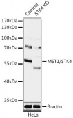 [KO Validated] MST1/STK4 Rabbit pAb (A18100)