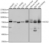 ACSS2 Rabbit pAb (A6472)