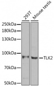 [KO Validated] TLK2 Rabbit pAb (A6770)