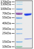 Active Recombinant Mouse PCSK9 Protein (RP01200)