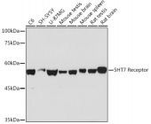 5HT7 Receptor Rabbit mAb (A19706)