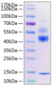 Active Recombinant Mouse TGF-beta 1  Protein (RP01167)