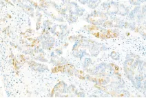 Anti -Collagen X Rabbit pAb