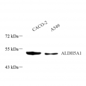 Anti -ALDH5A1/SSADH Rabbit pAb