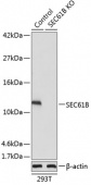 [KO Validated] SEC61B Rabbit pAb (A15788)