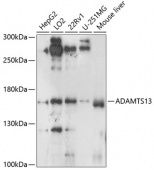 ADAMTS13 Rabbit pAb (A8482)