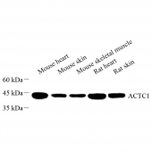 Anti -ACTC1 Rabbit pAb