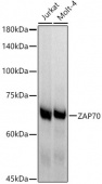 ZAP70 Rabbit mAb (A9536)