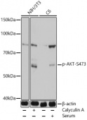Phospho-Akt-S473 Rabbit pAb (AP1068)