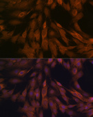 ULK3 Rabbit mAb (A5959)