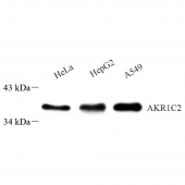 Anti -AKR1C1/AKR1C2 Rabbit pAb
