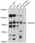 ADGRL4 Rabbit pAb (A14595)