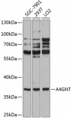A4GNT Rabbit pAb (A12366)