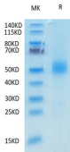 Recombinant Mouse GFRAL Protein (RP02212)