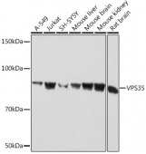 VPS35 Rabbit mAb (A9278)