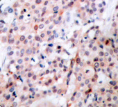 Phospho-Bcl-2-T56 Rabbit pAb (AP0316)