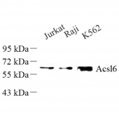Anti -ACSL6/ACS2 Rabbit pAb