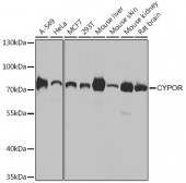 [KO Validated] CYPOR Rabbit pAb (A8142)