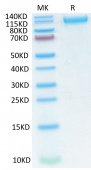 Recombinant SARS-COV-2 Spike S1(N501Y, K417N, E484K) Protein (RP02322)