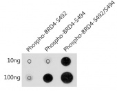 Phospho-BRD4-S492/S494 Rabbit pAb (AP1178)