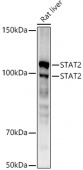 [KD Validated] STAT2 Rabbit mAb (A3588)